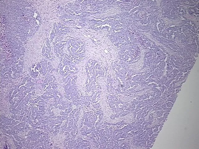 Tissue FFPE Sections, Ovary - image 1