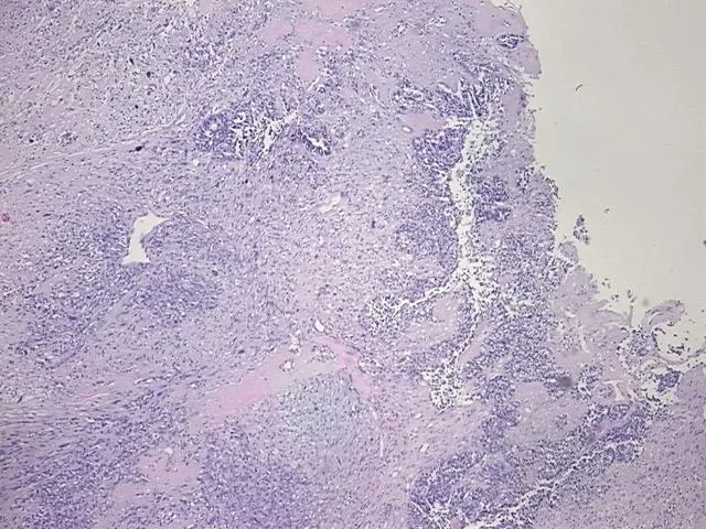 Tissue FFPE Sections, Fallopian tube - image 1