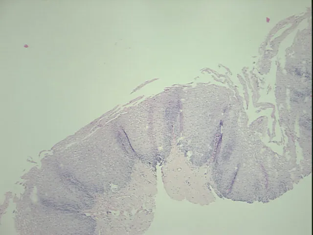Tissue FFPE Sections, Esophagus - image 1