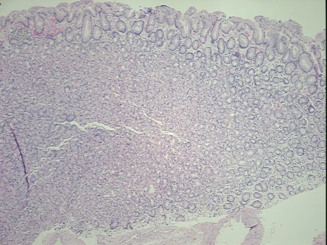 Tissue FFPE Sections, Stomach - image 1