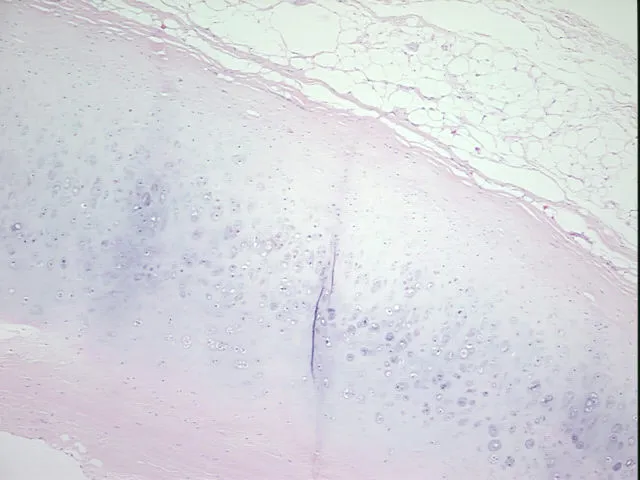 Tissue FFPE Sections, Cartilage - image 1