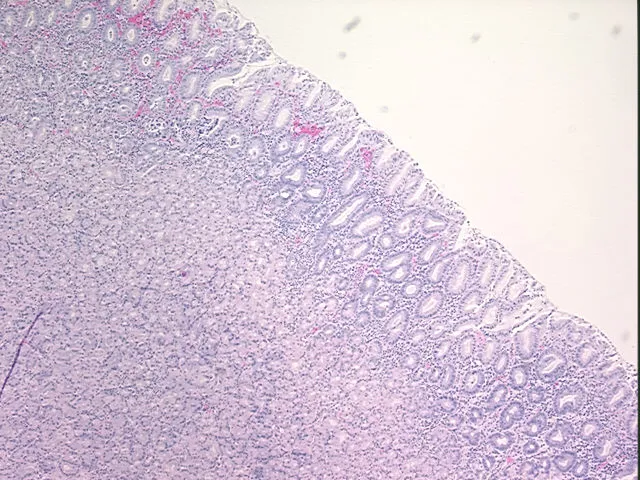 Tissue FFPE Sections, Stomach - image 1