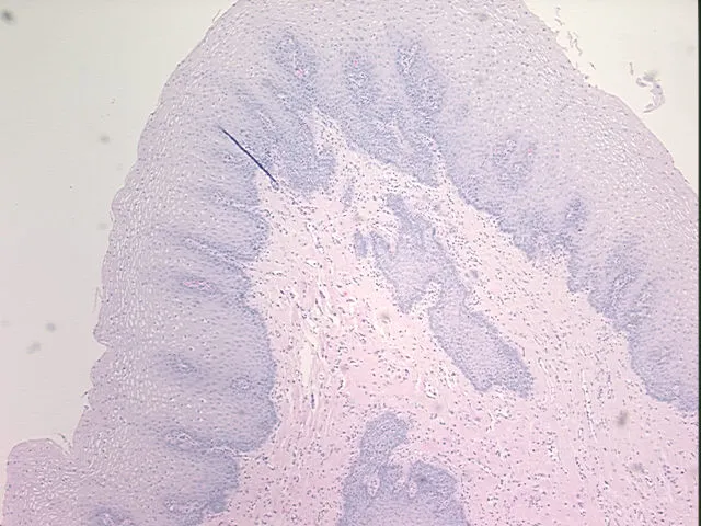 Tissue FFPE Sections, Esophagus - image 1