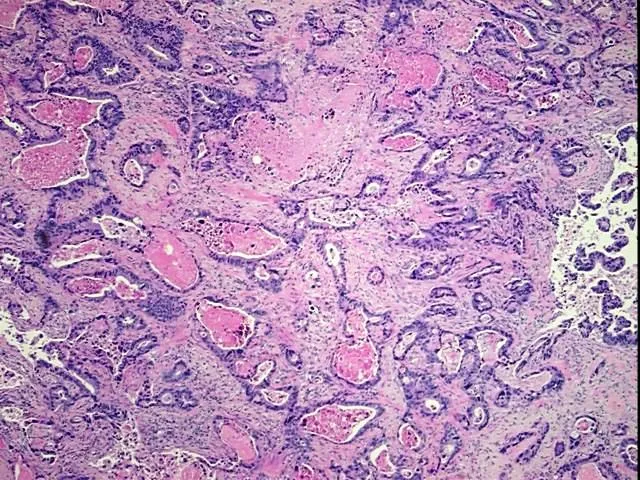 Tissue FFPE Sections, Esophagus - image 1