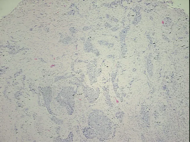 Tissue FFPE Sections, Endometrium - image 1