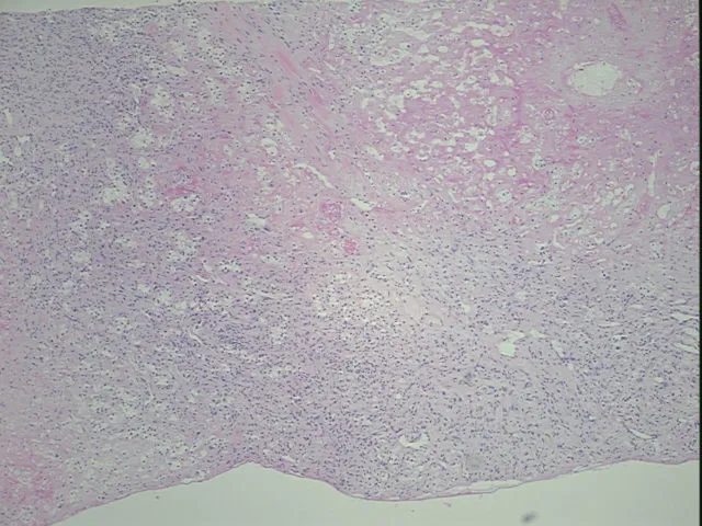 Tissue FFPE Sections, Kidney - image 1