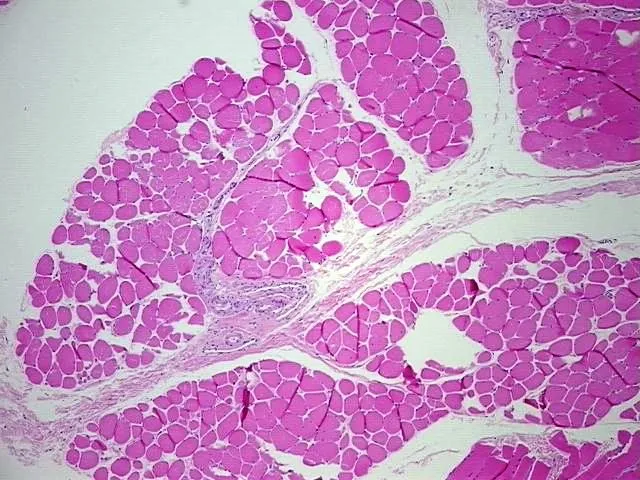 Tissue FFPE Sections, Muscle tissue - image 1