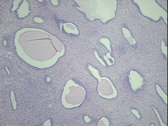 Tissue FFPE Sections, Uterus - image 1