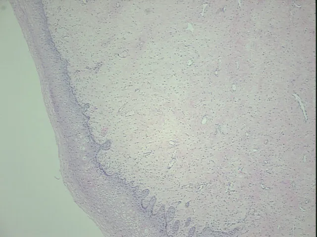 Tissue FFPE Sections, Cervix - image 1