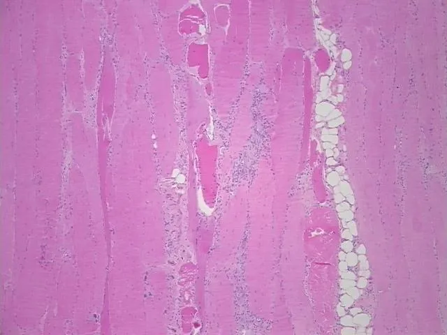 Tissue FFPE Sections, Muscle tissue - image 1