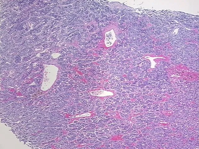 Tissue FFPE Sections, Neural tissue - image 1
