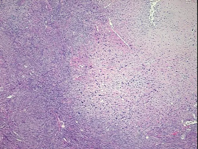 Tissue FFPE Sections, Bone - image 1