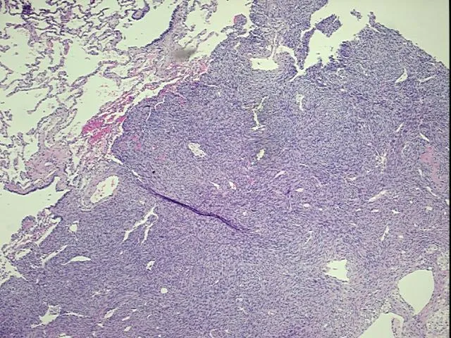 Tissue FFPE Sections, Bone - image 1
