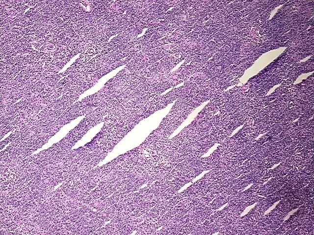 Frozen Tissue Sections, Lymphoid tissue - image 1