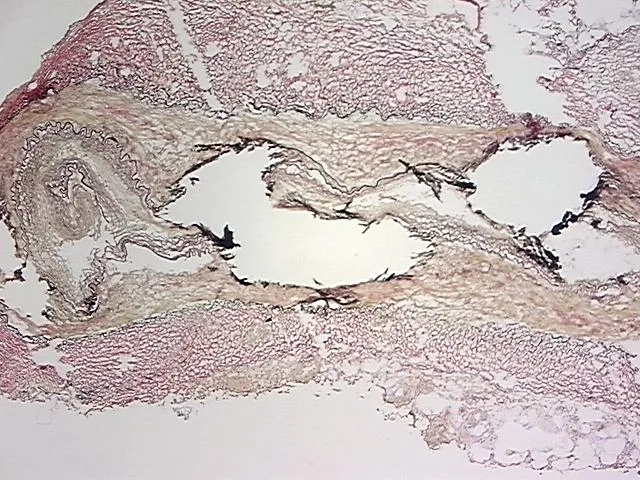 Frozen Tissue Sections, Neurovascular bundle - image 1