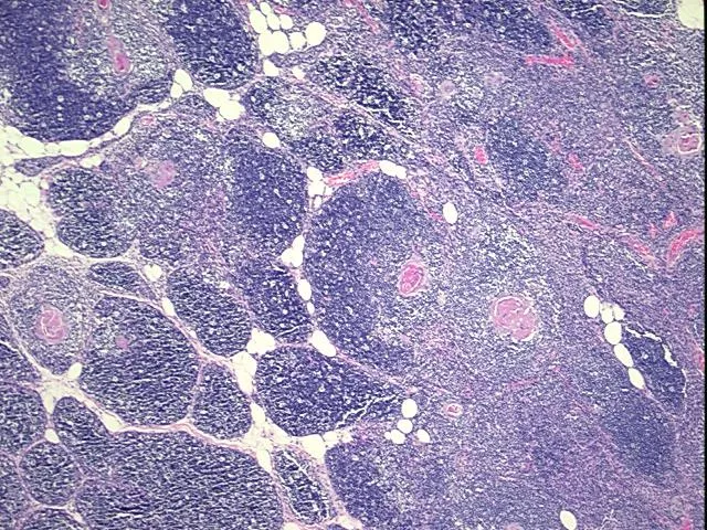 Tissue FFPE Sections, Thymus - image 1