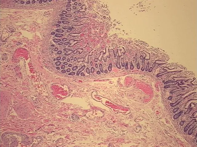 Tissue FFPE Sections, Duodenum - image 1