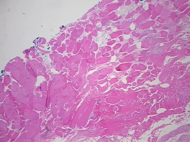 Tissue FFPE Sections, Muscle tissue - image 1