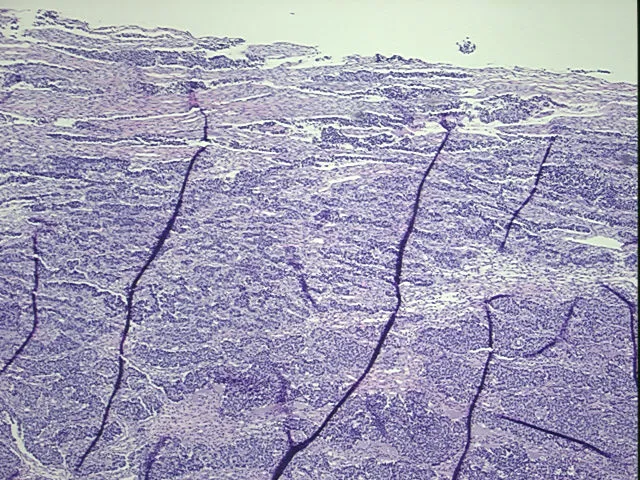 Tissue FFPE Sections, Cervix - image 1