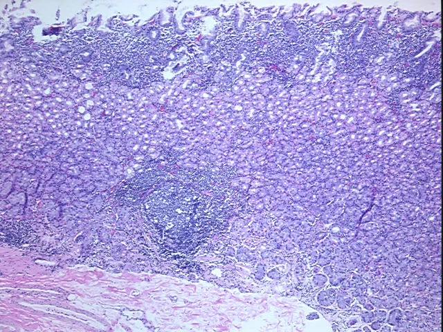Tissue FFPE Sections, Stomach - image 1