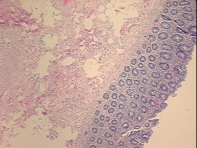 Tissue FFPE Sections, Colon - image 1