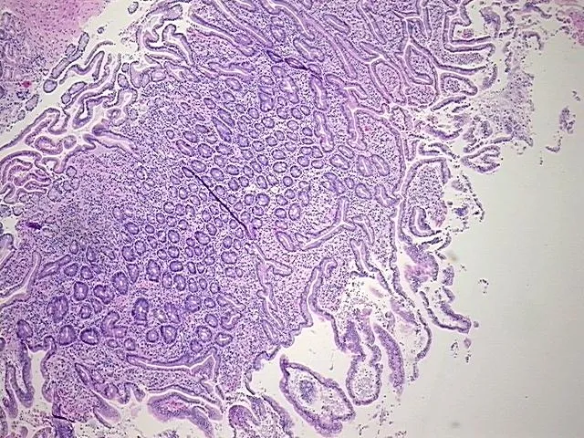 Tissue FFPE Sections, Duodenum - image 1