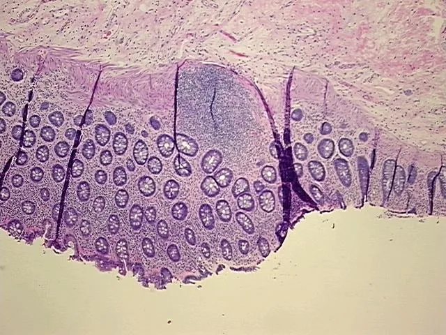 Tissue FFPE Sections, Rectum - image 1