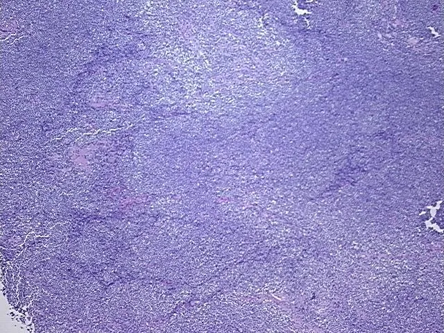 Tissue FFPE Sections, Lymphoid tissue - image 1