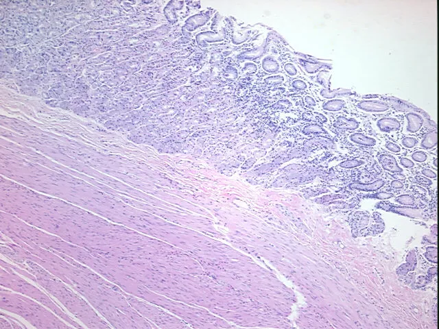 Tissue FFPE Sections, Stomach - image 1