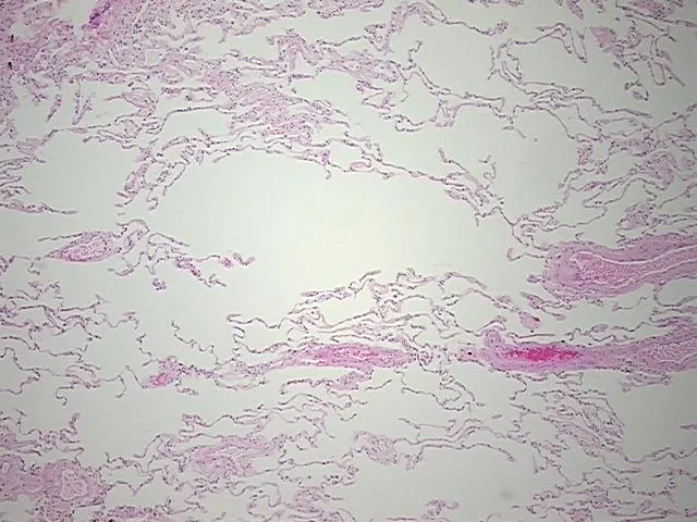 Tissue FFPE Sections, Lung - image 1