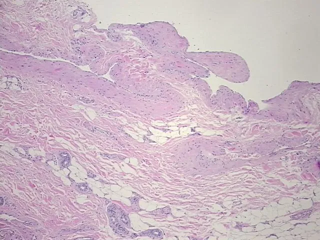 Tissue FFPE Sections, Penis - image 1