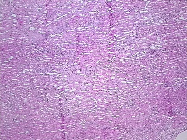 Tissue FFPE Sections, Kidney - image 1