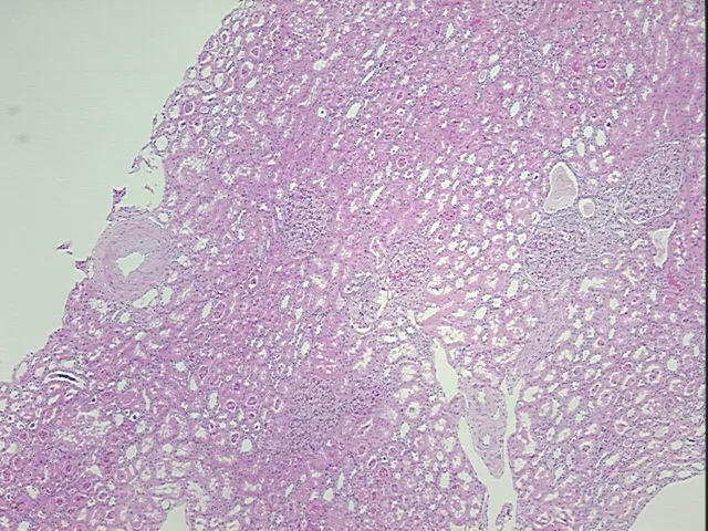 Tissue FFPE Sections, Kidney - image 1