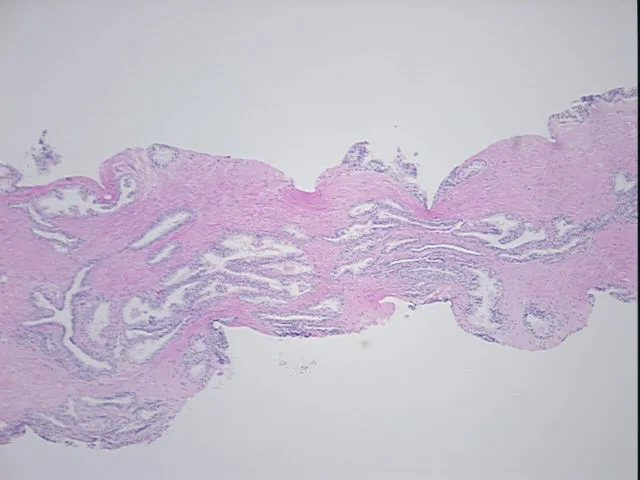Tissue FFPE Sections, Prostate - image 1