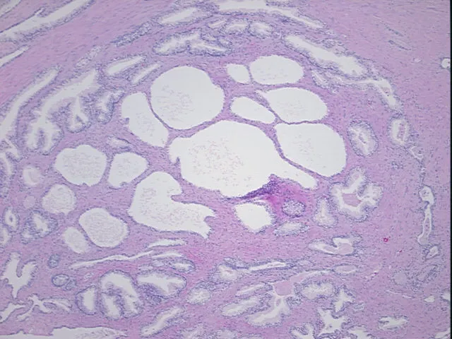 Tissue FFPE Sections, Prostate - image 1