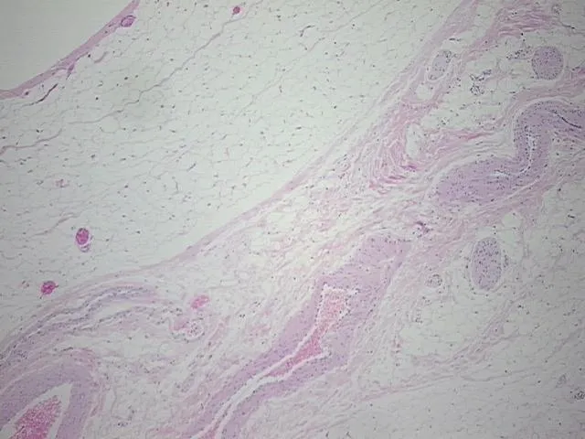 Tissue FFPE Sections, Adipose tissue - image 1