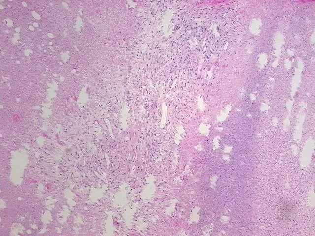 Tissue FFPE Sections, Kidney - image 1