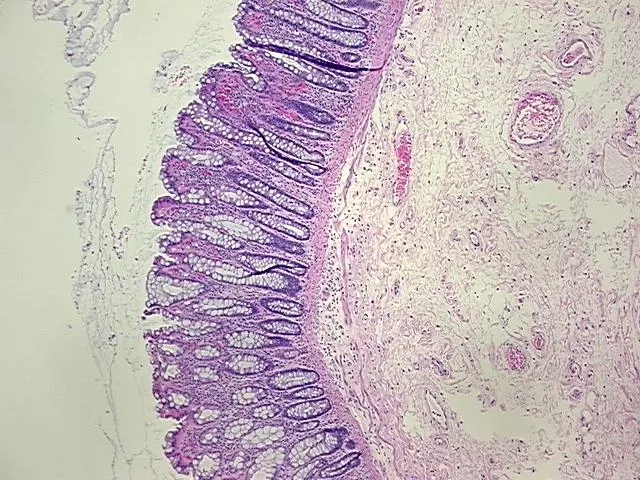 Tissue FFPE Sections, Rectum - image 1
