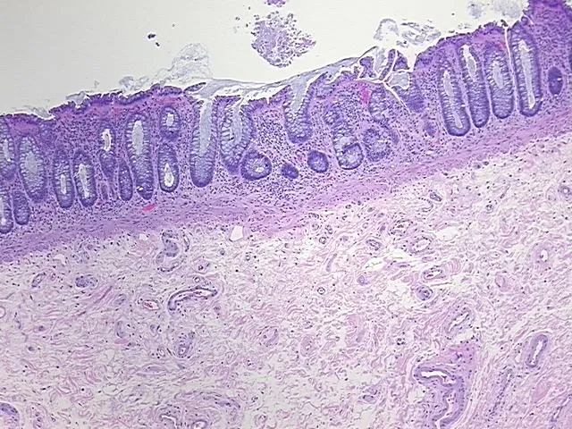 Tissue FFPE Sections, Rectum - image 1