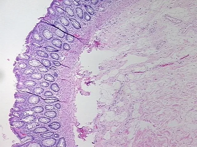 Tissue FFPE Sections, Rectum - image 1