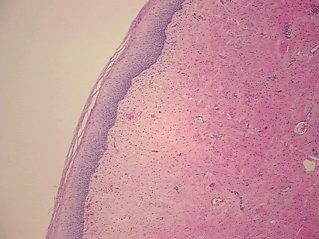 Tissue FFPE Sections, Cervix - image 1