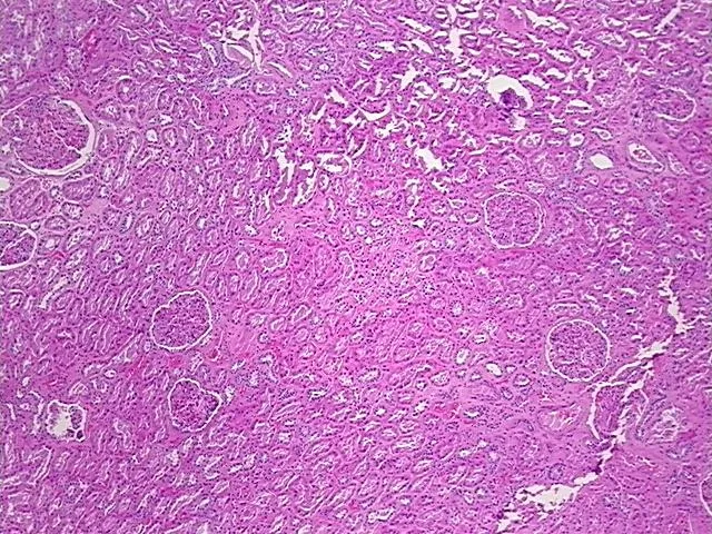 Tissue FFPE Sections, Kidney - image 1