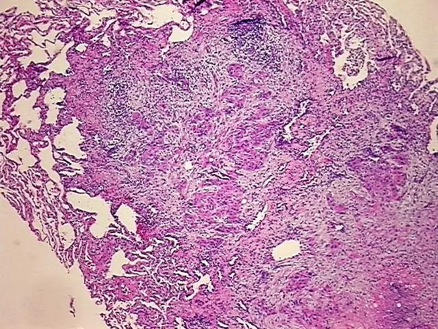Tissue FFPE Sections, Neck - image 1
