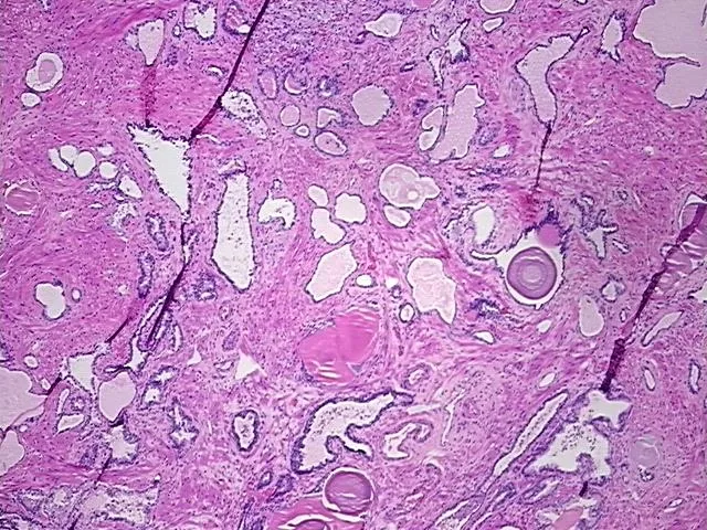 Tissue FFPE Sections, Prostate - image 1