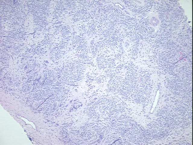 Tissue FFPE Sections, Testis - image 1