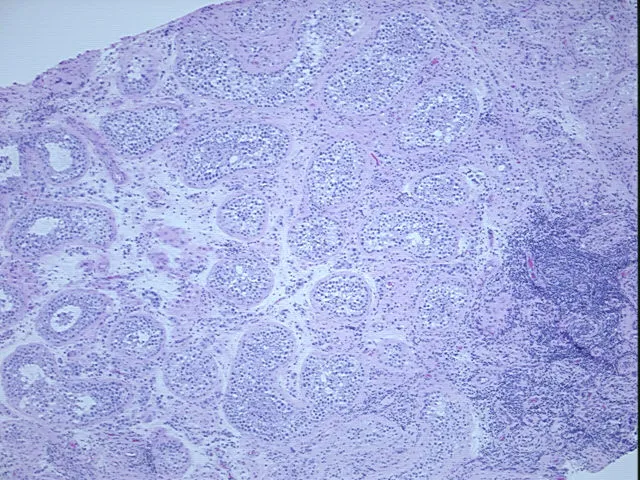 Tissue FFPE Sections, Testis - image 1