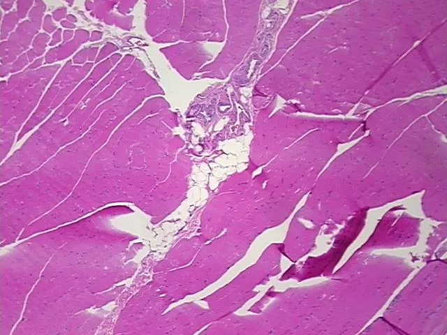 Tissue FFPE Sections, Muscle tissue - image 1