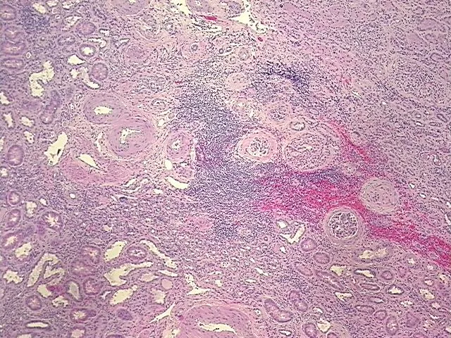 Tissue FFPE Sections, Kidney - image 1
