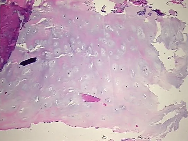 Tissue FFPE Sections, Joint - image 1