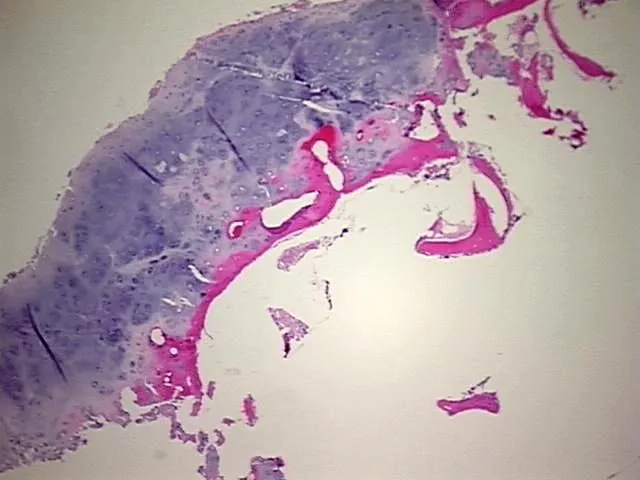 Tissue FFPE Sections, Joint - image 1